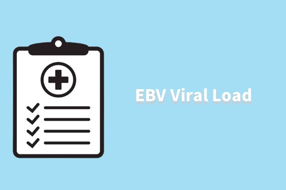 EBV Viral Load